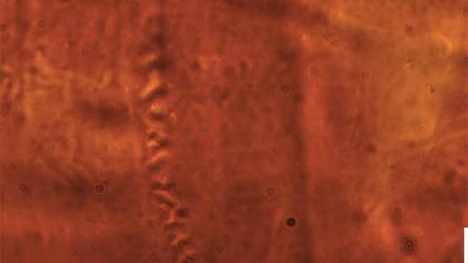 vorticella-3