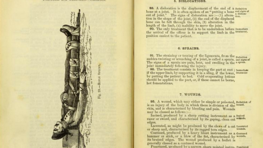 19th-century-splint