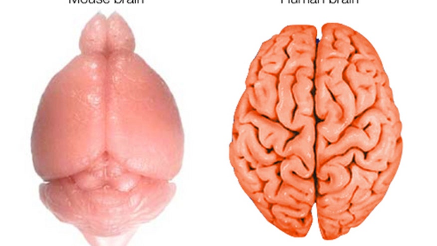 Mouse_Human_Brains_Horizontal