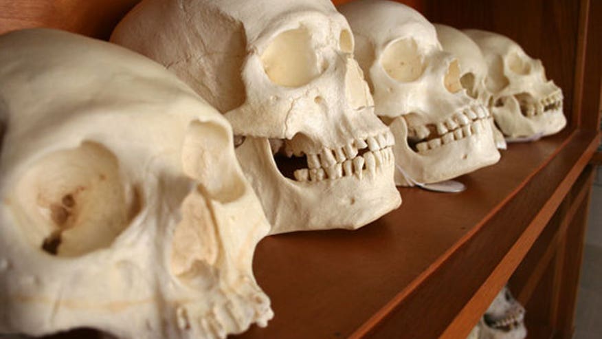 Skulls-sized