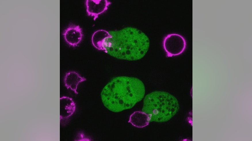 Parasitic Amoeba Chomps On Human Cells To Kill Them Fox News