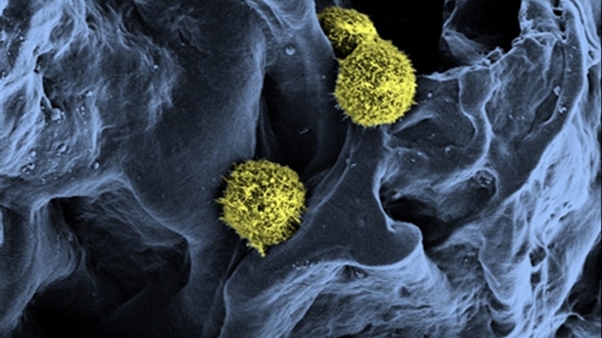 artificial-bone-marrow
