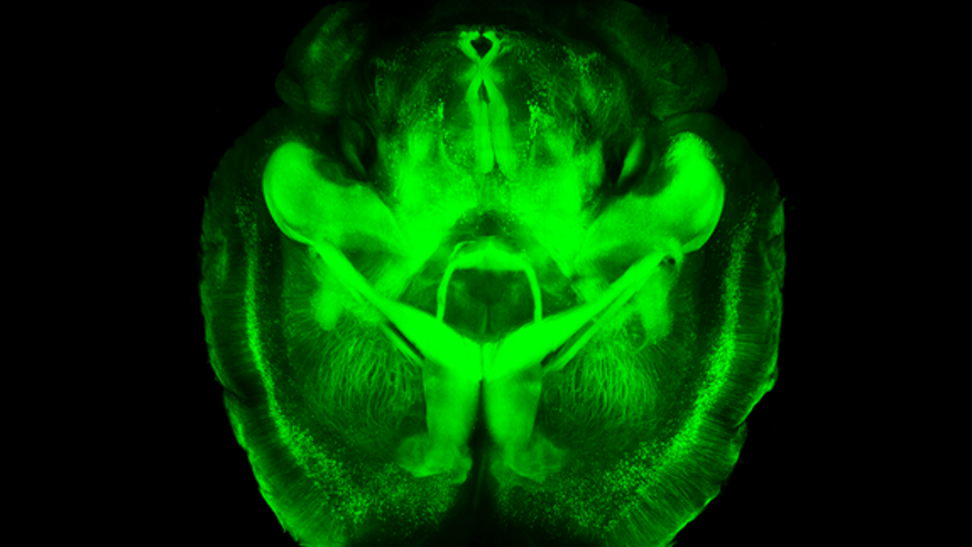 clarity-mouse-brain