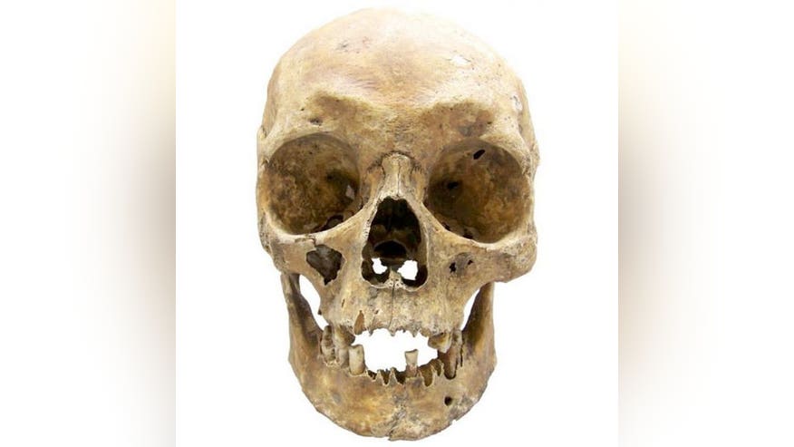 dead-general-skull