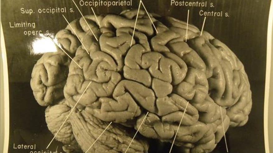 fig4-right-einstein-brain