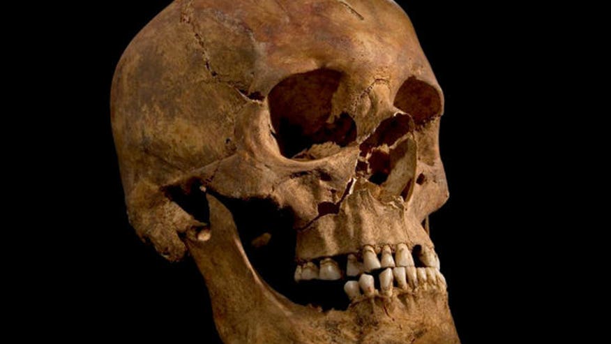 king-richard-skull