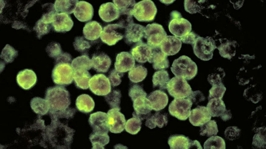 naegleria-fowleri