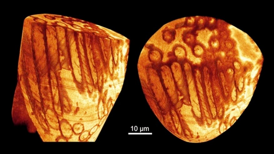 sperm-reconstruction