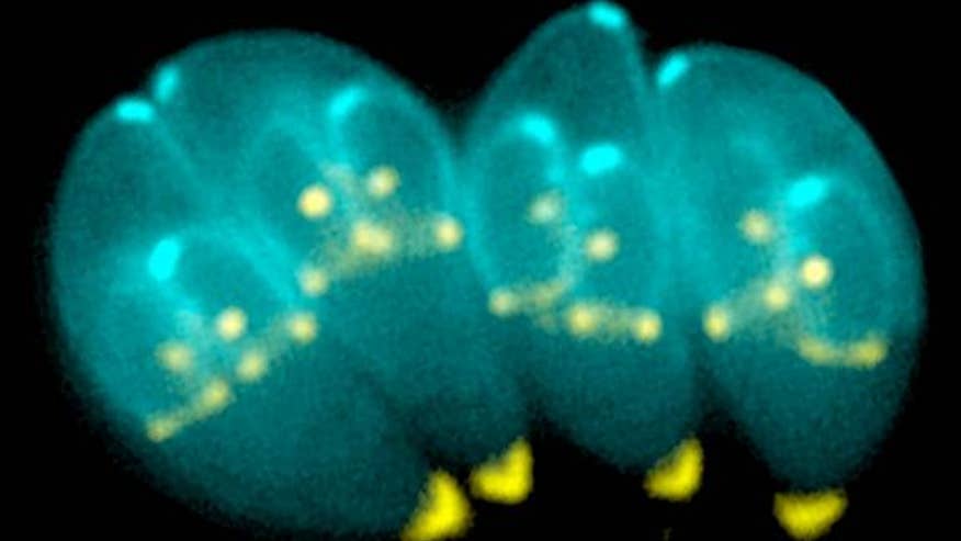 toxoplasma-gondii-parasite