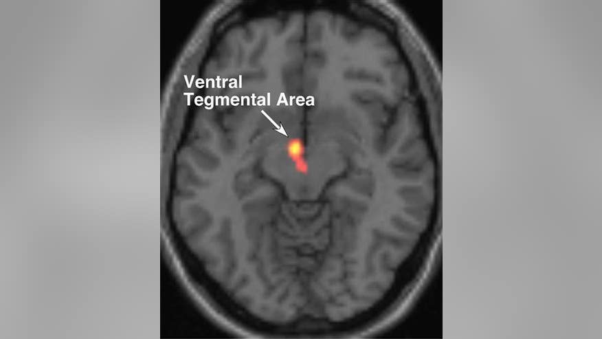 Think you use just 10% of your brain? That's a myth