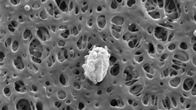 pollen-grain
