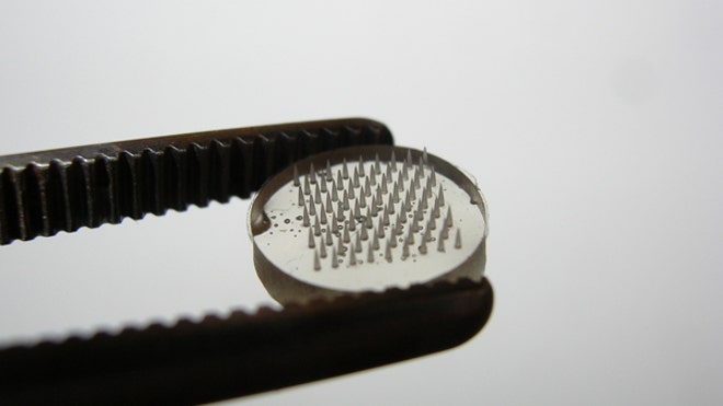 microneedle-patch
