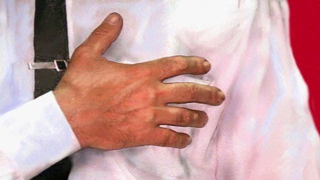 Acid reflux 101: Common causes, symptoms and treatments