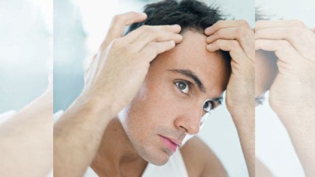 What to do if your hair starts thinning