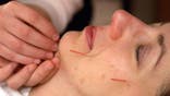 Americans are using acupuncture more to provide relief from pain and common ailments, according to a new survey