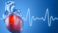 A widely used test to measure electrical activity in the heart may help identify elderly people at risk of a heart attack, said a study, rekindling a debate over the value of such tests in people without chest pain or other symptoms