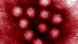 >Noroviruses are the most common cause of gastroenteritis in the United States, but there are ways to prevent it