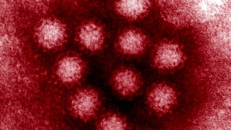 Noroviruses are the most common cause of gastroenteritis in the United States, but there are ways to prevent it