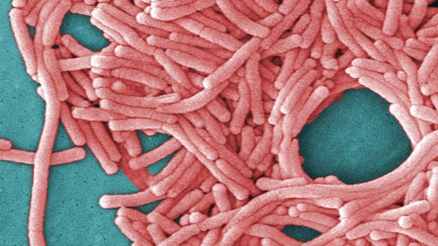 Six inmates at California prison diagnosed with Legionnaires' disease