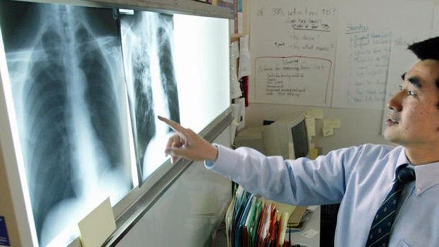 111812_anhq_tuberculosis_640.jpg