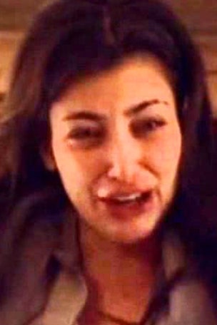 What happened to Kim’s face?