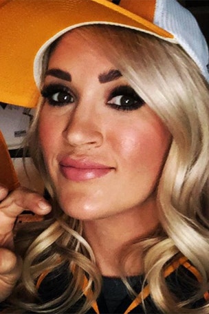 Carrie shows off scars
