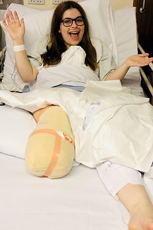 Simple break ends in amputation