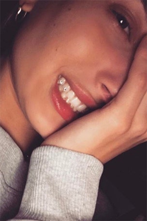 What's up with Baldwin's teeth?