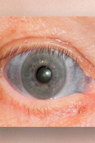Why did his eyes turn blue?