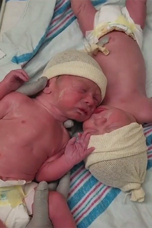 Twins' incredible bond moments after birth