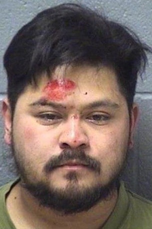 Man strips naked because Burger King is closed