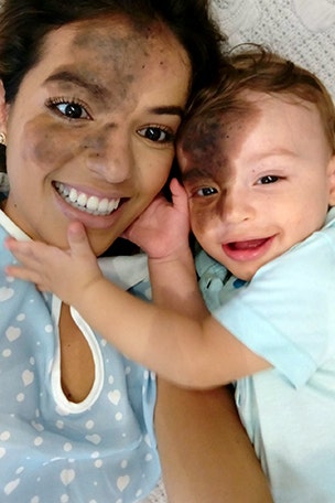 Mom paints birthmark to match son