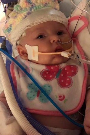 Baby hit by softball opens eyes