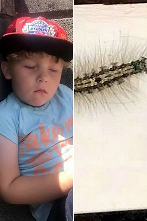 Caterpillar sent boy to ER?