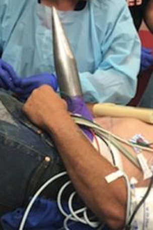 Dad survives gruesome injury