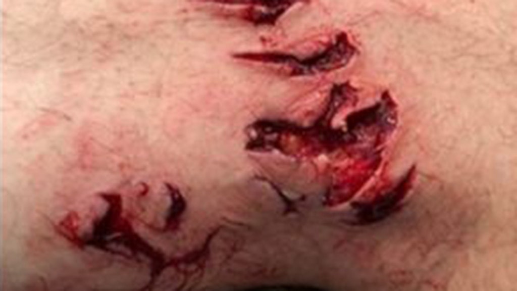 Man survives shark bite only to suffer potentially worse fate