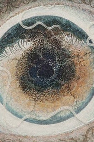 Artist: Worm in eye 'guided' me