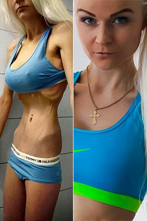 Barbie inspires blogger's recovery