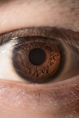 She got skin cancer in her EYE