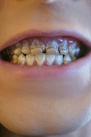 What happened to his teeth?!