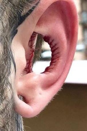 Controversial procedure goes viral, gets slammed