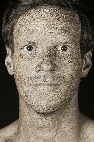 Pics reveal 'invisible' sun damage