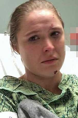 Star's SHOCKING injury revealed