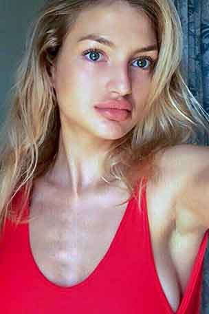 Model's pelvis shattered at billionaire bash