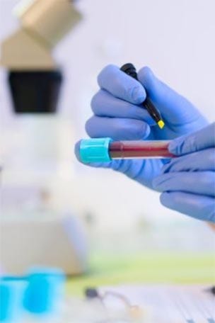 When will you die? Test may predict it