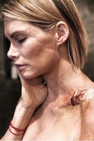 Stunt double lost her arm on set
