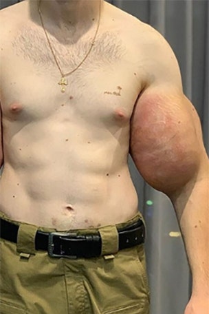 GRAPHIC IMAGES: 'It saturated the muscle tissues'
