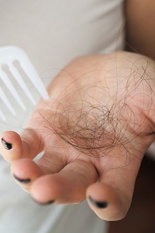 Is it alopecia or typical hair loss?