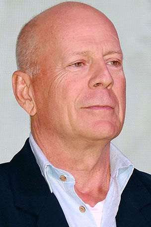 Actor KEPT working after aphasia diagnosis
