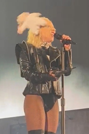 Gaga HIT in head during concert